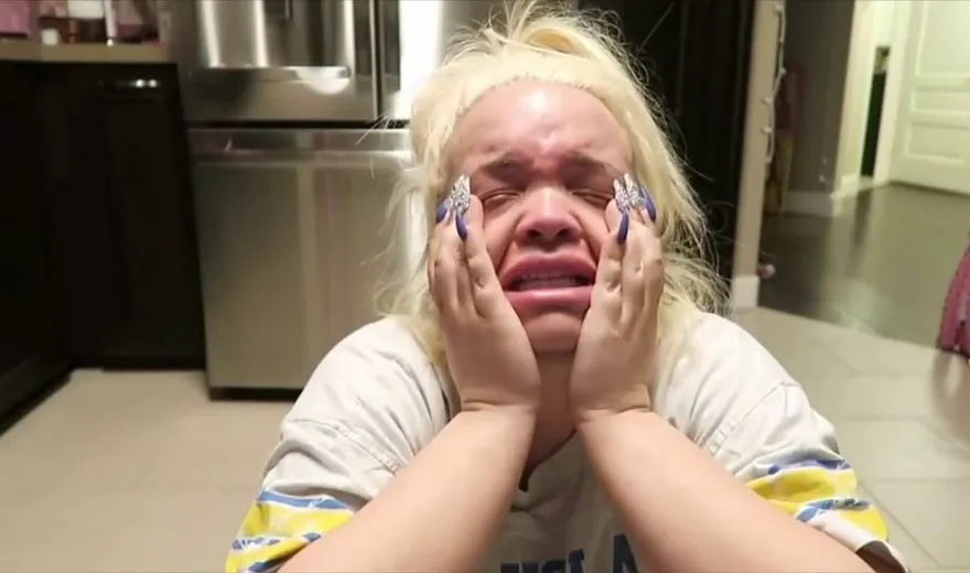 Monetising Mental Breakdowns